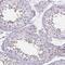 UL16 Binding Protein 3 antibody, HPA063007, Atlas Antibodies, Immunohistochemistry frozen image 