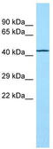 Torsin 1A Interacting Protein 2 antibody, TA331367, Origene, Western Blot image 