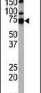 Histone Deacetylase 10 antibody, PA5-11247, Invitrogen Antibodies, Western Blot image 