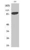 Signal Transducer And Activator Of Transcription 5A antibody, STJ95817, St John