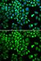 HCLS1 Associated Protein X-1 antibody, GTX54149, GeneTex, Immunofluorescence image 