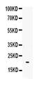 IL-6 antibody, RP1012, Boster Biological Technology, Western Blot image 