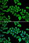 DEAD-Box Helicase 20 antibody, LS-C334313, Lifespan Biosciences, Immunofluorescence image 