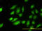 Tropomyosin 4 antibody, LS-C133492, Lifespan Biosciences, Immunofluorescence image 