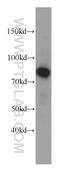Coilin antibody, 10967-1-AP, Proteintech Group, Western Blot image 