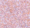 RB Binding Protein 8, Endonuclease antibody, A02076-1, Boster Biological Technology, Immunohistochemistry frozen image 