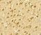 SWI/SNF Related, Matrix Associated, Actin Dependent Regulator Of Chromatin, Subfamily A, Member 4 antibody, A00223, Boster Biological Technology, Immunohistochemistry frozen image 