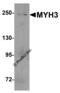 Myosin Heavy Chain 3 antibody, 8087, ProSci, Western Blot image 