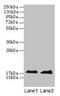 Myoglobin antibody, CSB-PA07917A0Rb, Cusabio, Western Blot image 
