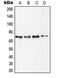 Ribosomal Protein S6 Kinase B1 antibody, MBS821374, MyBioSource, Western Blot image 