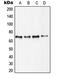 Ribosomal Protein S6 Kinase B1 antibody, MBS821374, MyBioSource, Western Blot image 