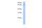 SRP Receptor Subunit Alpha antibody, PA5-41770, Invitrogen Antibodies, Western Blot image 