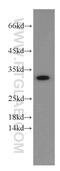 Voltage Dependent Anion Channel 2 antibody, 55261-1-AP, Proteintech Group, Western Blot image 