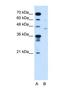 Fukutin antibody, NBP1-59640, Novus Biologicals, Western Blot image 