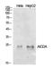 Activation Induced Cytidine Deaminase antibody, STJ97261, St John