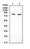 Phosphoinositide-3-Kinase Regulatory Subunit 2 antibody, LS-C312832, Lifespan Biosciences, Western Blot image 