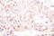 SUMO Peptidase Family Member, NEDD8 Specific antibody, LS-C176351, Lifespan Biosciences, Immunohistochemistry paraffin image 