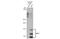 Transient Receptor Potential Cation Channel Subfamily V Member 2 antibody, GTX101868, GeneTex, Western Blot image 