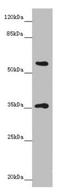 G Protein Subunit Beta 1 Like antibody, LS-C682118, Lifespan Biosciences, Western Blot image 