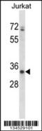 ADP-Ribosyltransferase 3 antibody, 57-824, ProSci, Western Blot image 