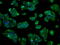 Cytochrome P450 Family 2 Subfamily E Member 1 antibody, M00672-1, Boster Biological Technology, Immunofluorescence image 