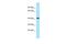 Peptidoglycan Recognition Protein 3 antibody, A09197, Boster Biological Technology, Western Blot image 