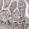 Methyltransferase Like 14 antibody, NBP2-59044, Novus Biologicals, Immunohistochemistry frozen image 