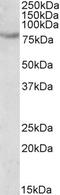 SIM BHLH Transcription Factor 2 antibody, EB10569, Everest Biotech, Western Blot image 