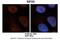 Eukaryotic Translation Initiation Factor 3 Subunit G antibody, PA5-41774, Invitrogen Antibodies, Immunohistochemistry paraffin image 