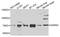 Aspartyl-TRNA Synthetase 2, Mitochondrial antibody, A7813, ABclonal Technology, Western Blot image 