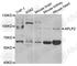 Amyloid Beta Precursor Like Protein 2 antibody, A5455, ABclonal Technology, Western Blot image 