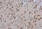 Ribosomal Protein L3 antibody, NBP2-20214, Novus Biologicals, Immunohistochemistry paraffin image 
