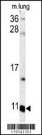 S100 Calcium Binding Protein A6 antibody, MBS9210922, MyBioSource, Western Blot image 