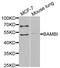 BMP And Activin Membrane Bound Inhibitor antibody, abx005011, Abbexa, Western Blot image 