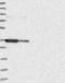 CD200 Molecule antibody, NBP1-87738, Novus Biologicals, Western Blot image 