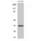 Cyclin Dependent Kinase 2 antibody, LS-C381206, Lifespan Biosciences, Western Blot image 