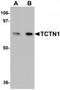 Tectonic Family Member 1 antibody, TA320013, Origene, Western Blot image 