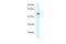 WD Repeat Containing, Antisense To TP73 antibody, A12198, Boster Biological Technology, Western Blot image 