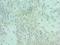 Alsin Rho Guanine Nucleotide Exchange Factor ALS2 antibody, LS-C379194, Lifespan Biosciences, Immunohistochemistry frozen image 