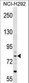 Cartilage Acidic Protein 1 antibody, LS-C159410, Lifespan Biosciences, Western Blot image 