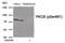 Protein Kinase C Beta antibody, 79-957, ProSci, Western Blot image 