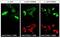 Stathmin-2 antibody, NBP1-49461, Novus Biologicals, Immunocytochemistry image 