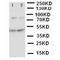Minichromosome Maintenance Complex Component 3 antibody, orb76165, Biorbyt, Western Blot image 