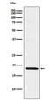 Translocase Of Outer Mitochondrial Membrane 22 antibody, M08668, Boster Biological Technology, Western Blot image 