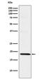 Mitochondrial import receptor subunit TOM22 homolog antibody, M08668, Boster Biological Technology, Western Blot image 