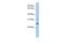 Dehydrogenase/Reductase 1 antibody, GTX45742, GeneTex, Western Blot image 