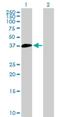 Suppressor Of Variegation 3-9 Homolog 2 antibody, H00079723-B01P, Novus Biologicals, Western Blot image 