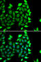 High Mobility Group 20A antibody, A07758, Boster Biological Technology, Western Blot image 