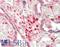 Calcyclin antibody, LS-B14933, Lifespan Biosciences, Immunohistochemistry paraffin image 