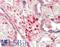 S100 Calcium Binding Protein A6 antibody, LS-B14933, Lifespan Biosciences, Immunohistochemistry paraffin image 